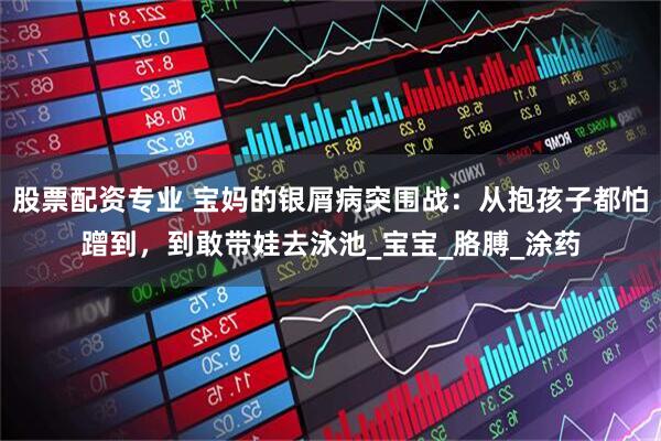 股票配资专业 宝妈的银屑病突围战：从抱孩子都怕蹭到，到敢带娃去泳池_宝宝_胳膊_涂药